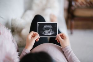 Busting Myths About Ultrasounds